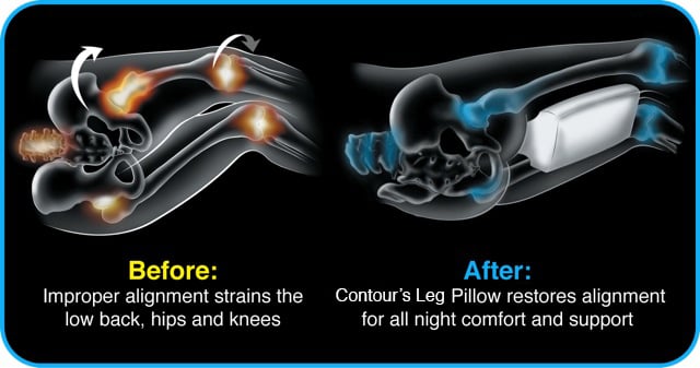 BeforeandAfter-LegPillow