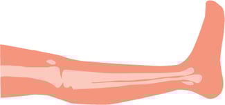leg zone2
