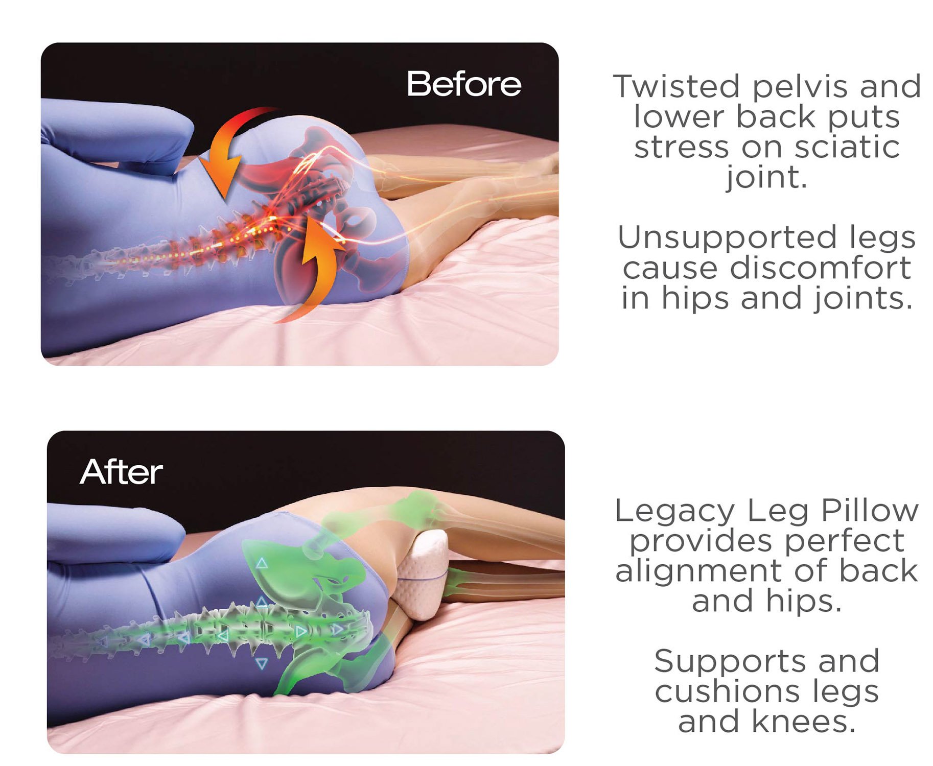 https://www.contourproducts.com/hubfs/29-450_LegacyLeg_before-after-5.jpg